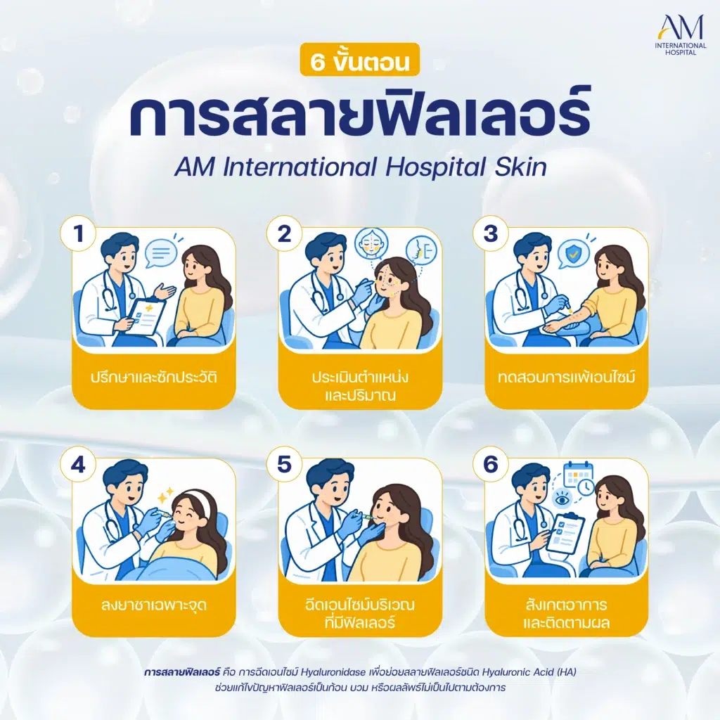 ขั้นตอนการสลายฟิลเลอร์