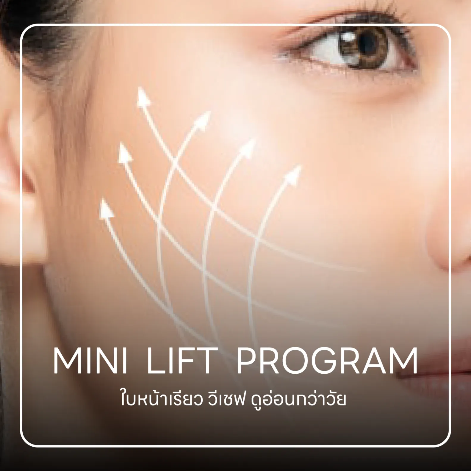 mini face lift 
