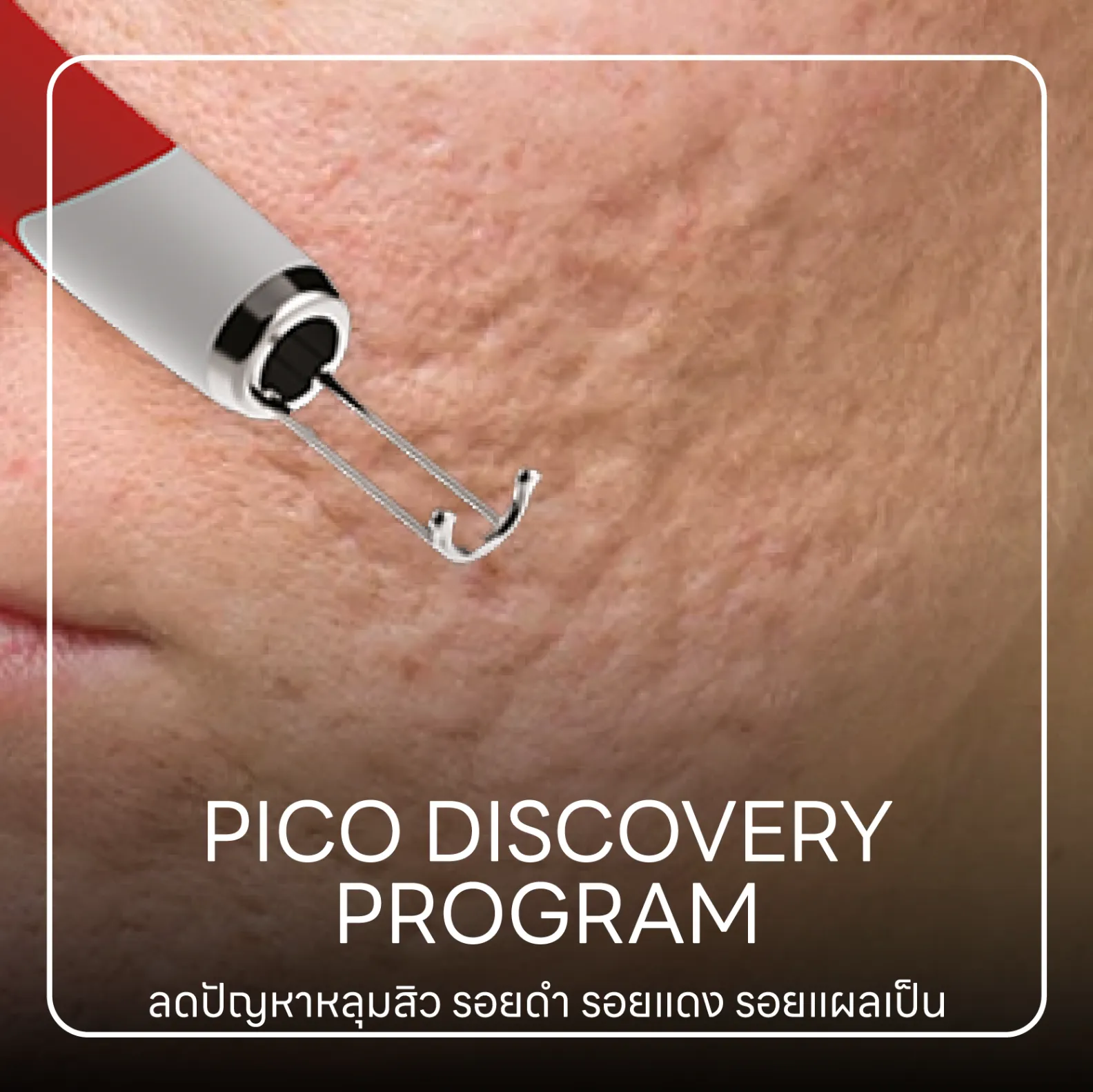 Pico โปรแกรม