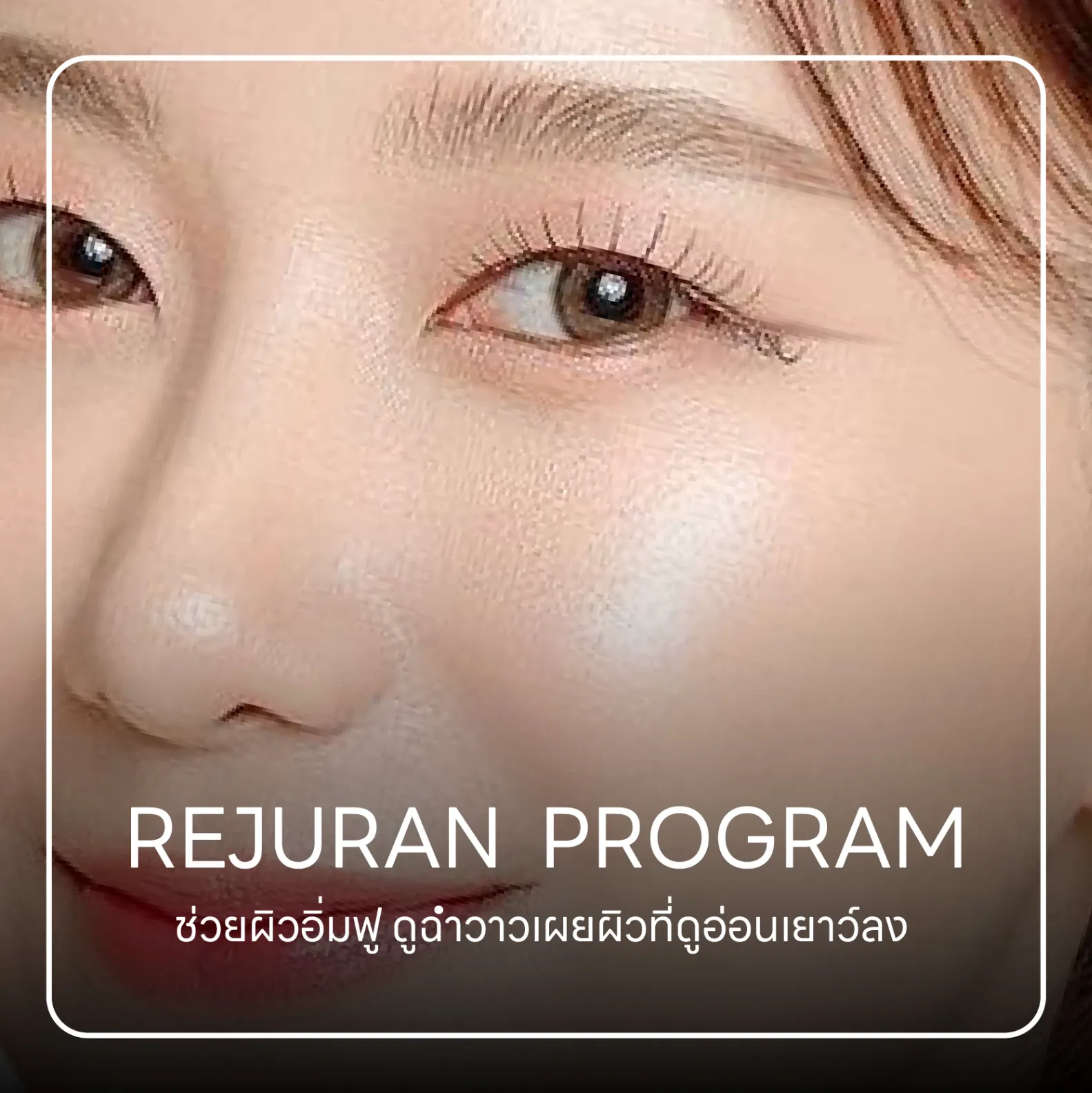 รีจูรัน โปรแกรม