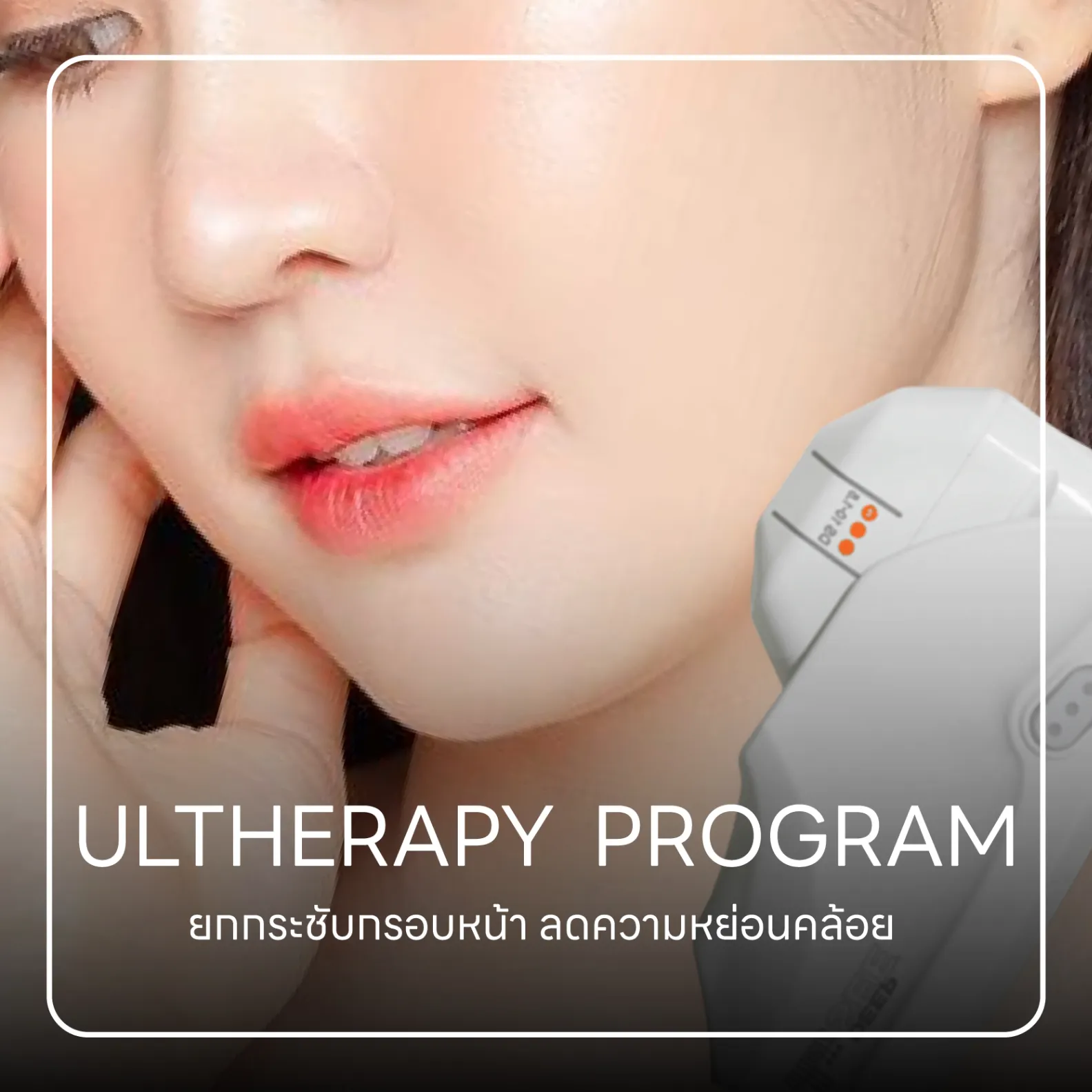 ultherapy โปรแกรม